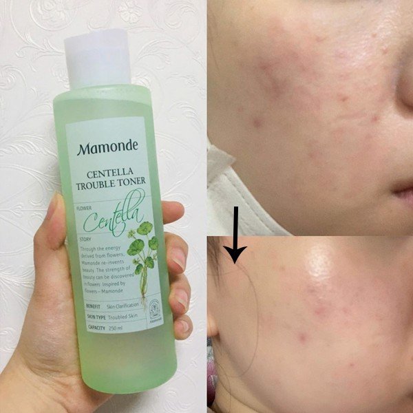 Nước Hoa Hồng Rau Má Mamonde Centella Trouble Toner